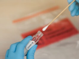 Coronavirus, sono 160 i nuovi positivi. Nessun decesso, ma aumentano di 5 i ricoverati