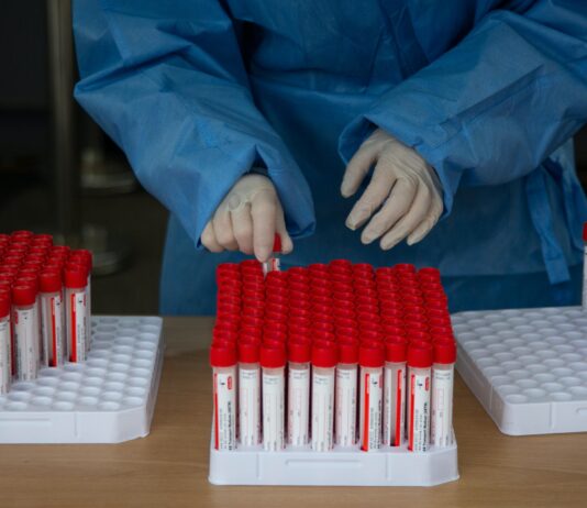 Ultra 50enne rifiuta il vaccino e si rivolge al giudice. L’ordine del Tribunale, “analizzate la composizione” Covid nelle Marche (ancora in arancione): numeri in calo, ma da martedì obbligo super green pass per i 50enni nei luoghi di lavoro