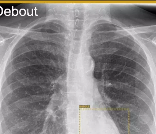 Sanità del futuro: l’intelligenza artificiale in aiuto ai radiologi di Pesaro e Fano. Rebonato: “Ma l’uomo resta al centro”